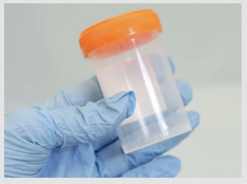 Urine sample bottle ClearHealthCosts
